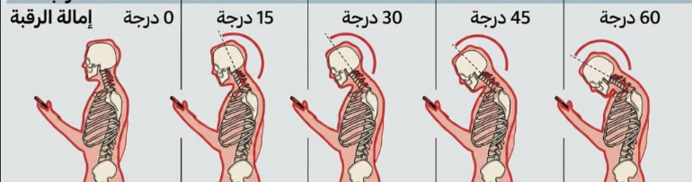 وضعيات الرقبة